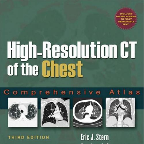 High-Resolution CT of the Chest-Comprehensive Atlas, 3rd Edition