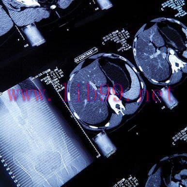 [AME]NYU Langone&rsquo;s Head to Toe Imaging 2022 (CME VIDEOS)