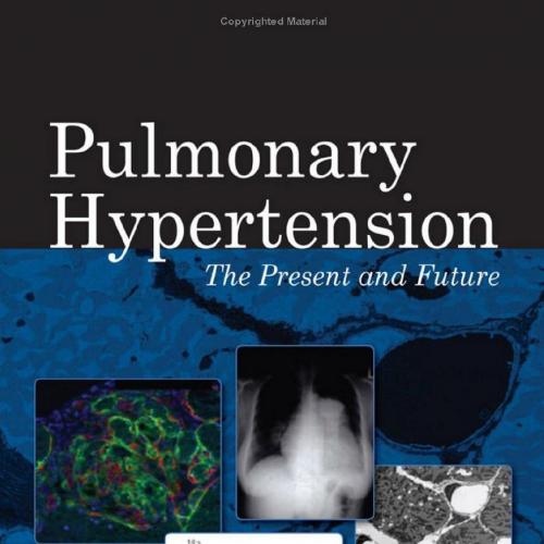 Pulmonary Hypertension The Present and Future