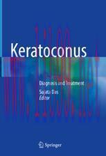 [PDF]Keratoconus: Diagnosis and Treatment