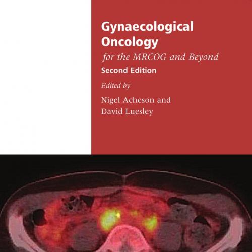 Gynaecological Oncology for the MRCOG and Beyond, second edition