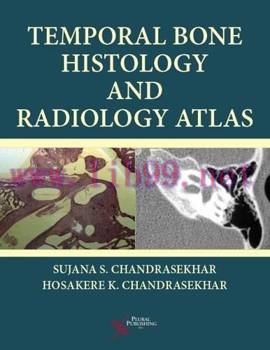 [AME]Temporal Bone Histology and Radiology Atlas (Original PDF)