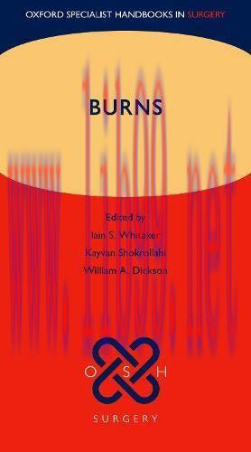 [AME]Burns (Oxford Specialist Handbooks in Surgery) (PDF)
