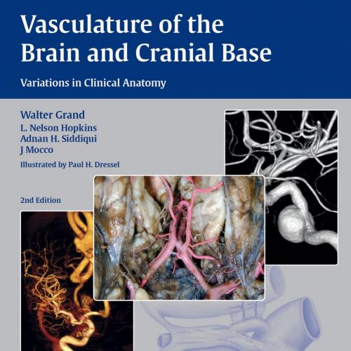 Vasculature of the Brain and Cranial Base Variations in Clinical Anatomy, 2nd Edition
