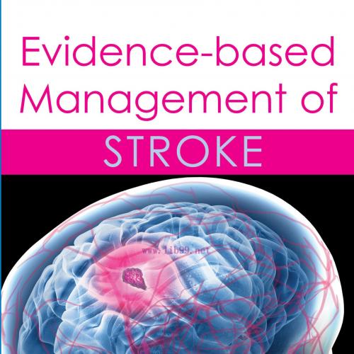 [AME]Evidence-based Management of Stroke (EPUB)