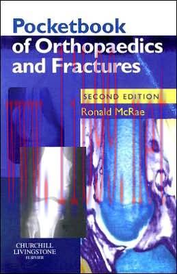 [AME]Pocketbook of Orthopaedics and Fractures, 2nd Edition