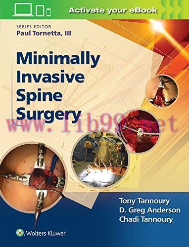 [AME]Minimally Invasive Spine Surgery (Epub)