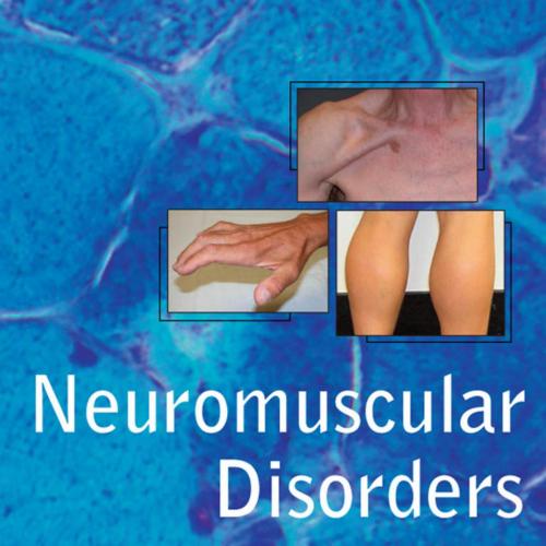 Neuromuscular Disorders