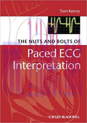 (PDF)The Nuts and bolts of Paced ECG Interpretation (Nuts and Bolts Series (Replaced by 5113) B...