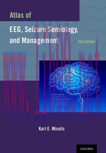 [AME]Atlas of EEG, Seizure Semiology, and Management, 2nd Edition (Original PDF)