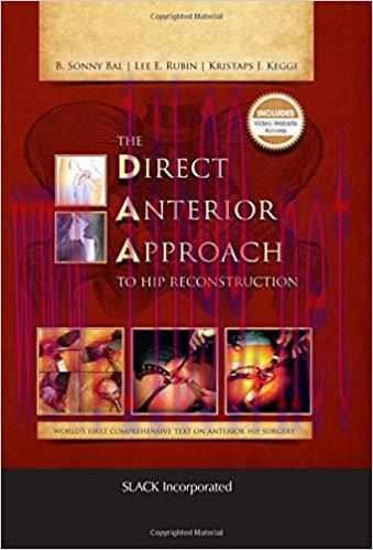 [PDF]The Direct Anterior Approach To Hip Reconstruction