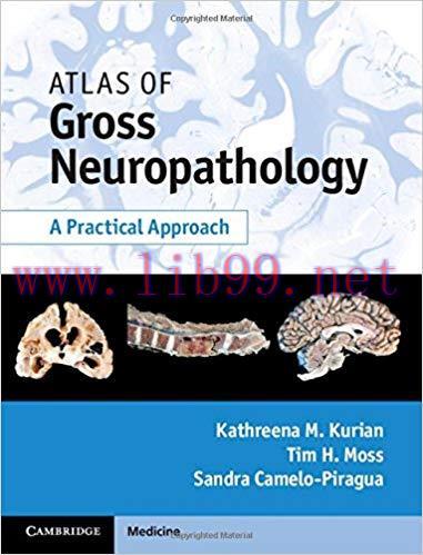[CHM]Atlas of Gross Neuropathology - A Practical Approach