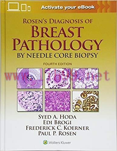[CHM]Rosen&rsquo;s Diagnosis of Breast Pathology by Needle Core Biopsy 4th Edition