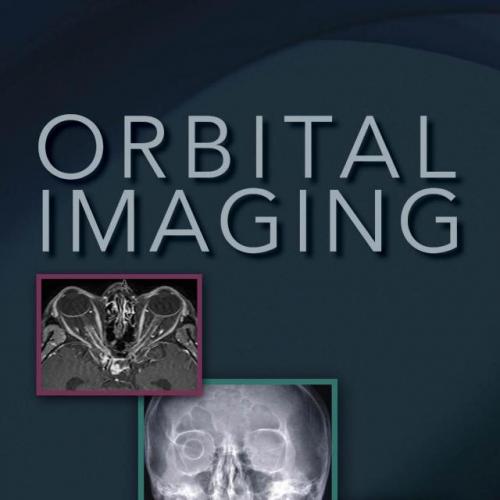 Orbital Imaging