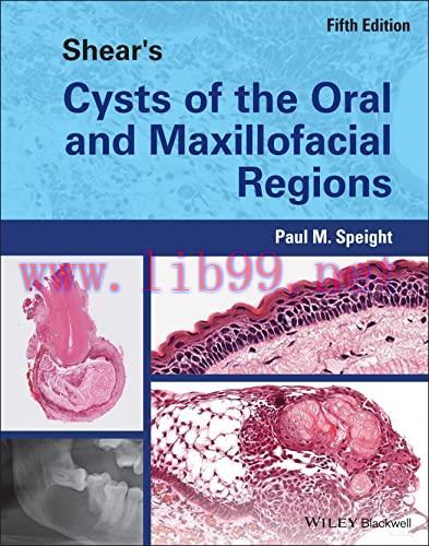 [AME]Shear&rsquo;s Cysts of the Oral and Maxillofacial Regions, 5th Edition (Original PDF)
