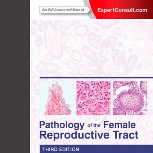 Pathology of the Female Reproductive Tract, 3rd Edition