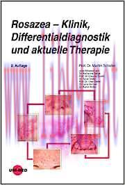 [AME]Rosazea &ndash; Klinik, Differentialdiagnostik und aktuelle Therapie (UNI-MED Science), 2nd Edit...