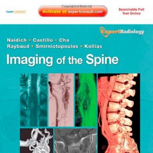 Imaging of the Spine