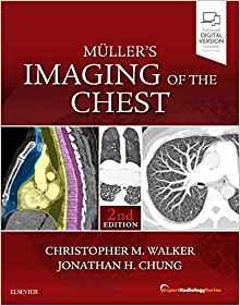 Muller&rsquo;s Imaging of the Chest Expert Radiology Series 2nd Edition