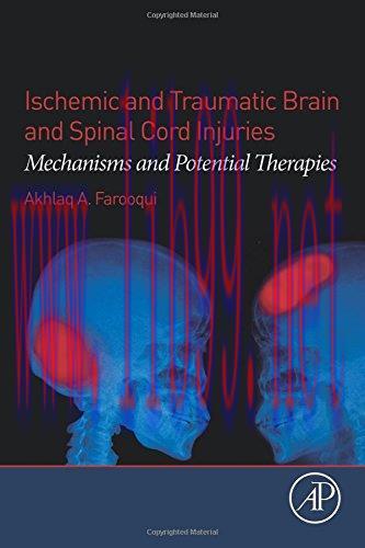 [AME]Ischemic and Traumatic Brain and Spinal Cord Injuries: Mechanisms and Potential Therapies ...