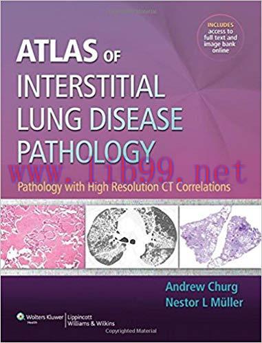 [PDF]Atlas of Interstitial Lung Disease Pathology