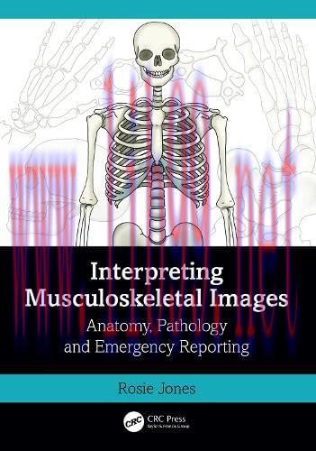 [FOX-Ebook]Interpreting Musculoskeletal Images: Anatomy, Pathology and Emergency Reporting