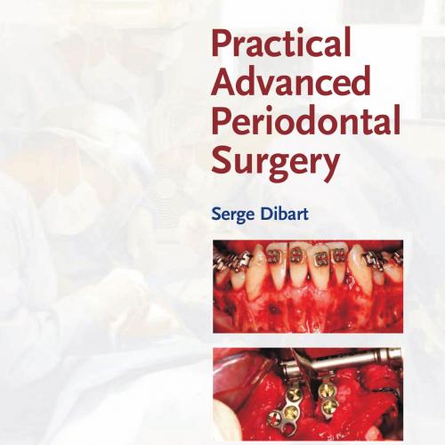 Practical Advanced Periodontal Surgery