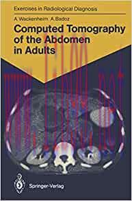 [AME]Computed Tomography of the Abdomen in Adults: 85 Radiological Exercises for Students and P...