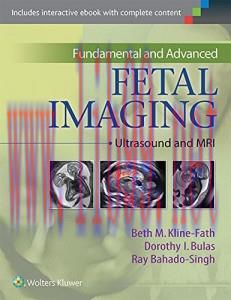 [AME]Fundamental and Advanced Fetal Imaging: Ultrasound and MRI (EPUB)