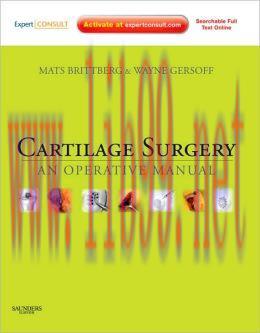 [AME]Cartilage Surgery: An Operative Manual