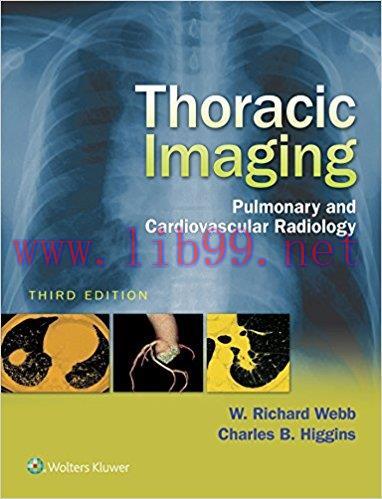 [AME]Thoracic Imaging: Pulmonary and Cardiovascular Radiology, 3rd Edition (EPUB)