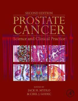 [AME]Prostate Cancer: Science and Clinical Practice, 2nd Edition
