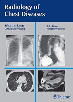 Radiology of Chest Diseases, 3rd Edition