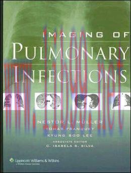 [AME]Imaging of Pulmonary Infections (ORIGINAL PDF from_ Publisher)