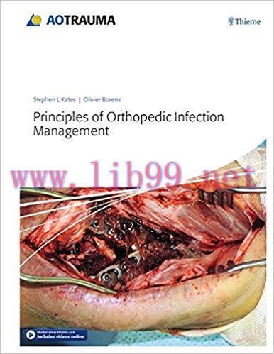 [PDF]Principles of Orthopedic Infection Management + VIDEOS