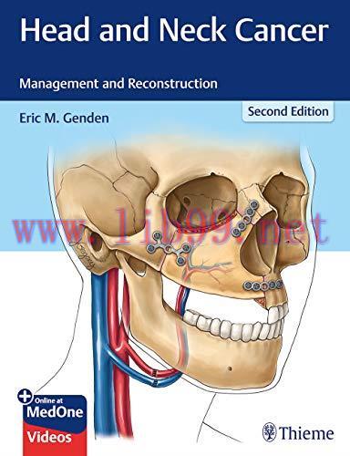 [AME]Head and Neck Cancer: Management and Reconstruction, 2nd Edition (Original PDF)