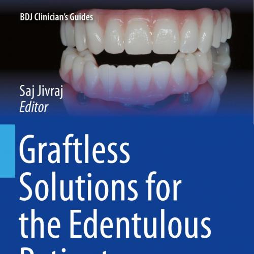 Graftless Solutions for the Edentulous Patient - Wei Zhi