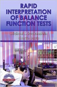 [AME]Rapid Interpretation of Balance Function Tests