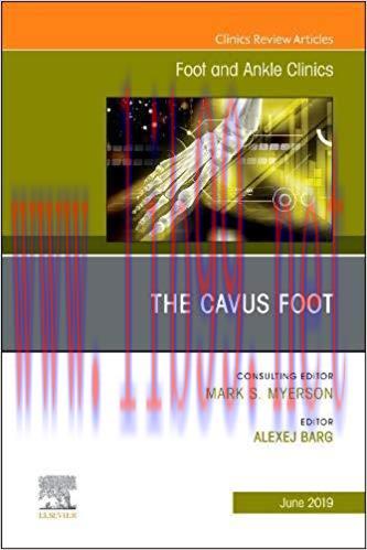 [PDF]The Cavus Foot