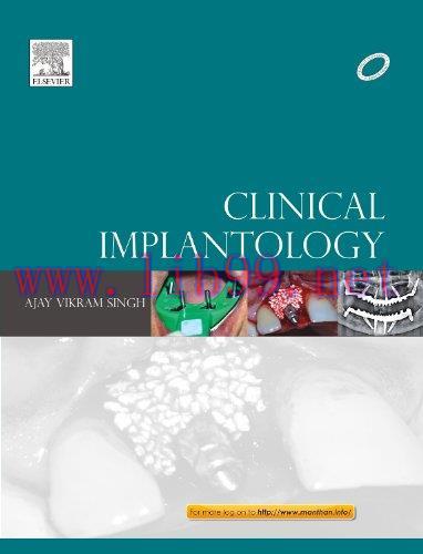 [AME]Clinical Implantology