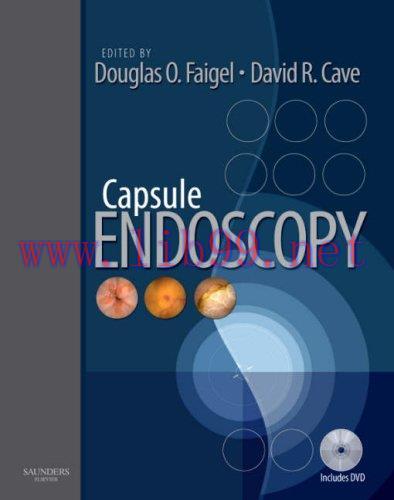 [AME]Capsule Endoscopy (Original PDF)
