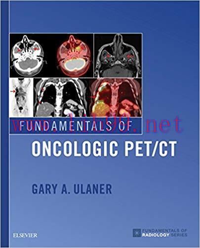 [AME]Fundamentals of Oncologic PET/CT (Fundamentals of Radiology) (PDF)