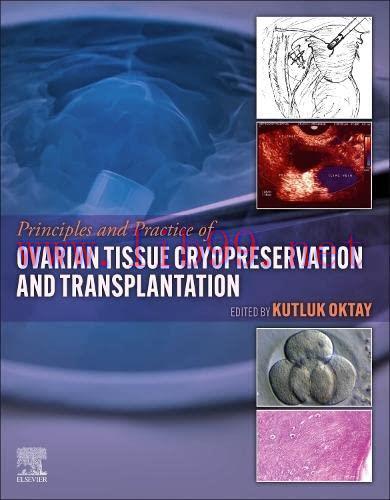 [AME]Principles and Practice of Ovarian Tissue Cryopreservation and Transplantation (Original P...