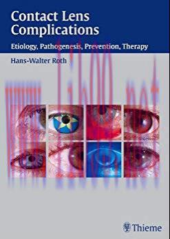 [PDF]Contact Lens Complications, 1e [Thieme] [2003]