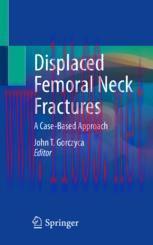 [PDF]Displaced Femoral Neck Fractures: A Case-Based Approach