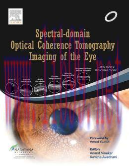[AME]Spectral Domain OCT
