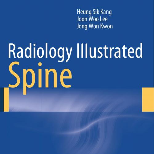 Radiology Illustrated Spine