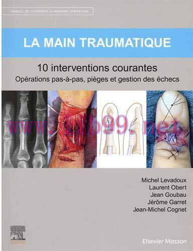 [AME]La main traumatique 10 interventions courantes: Manuel de chirurgie du membre sup&eacute;rieur (H...