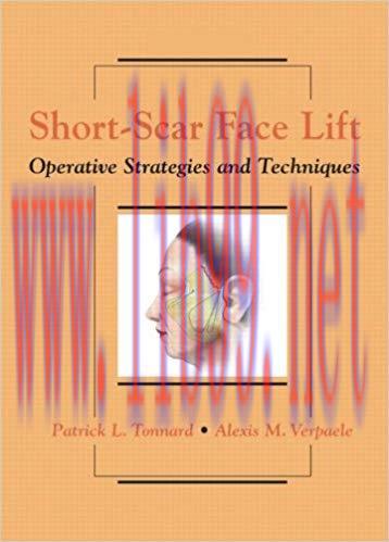 [PDF]Short-Scar Face Lift - Operative Strategies and Techniques + Videos