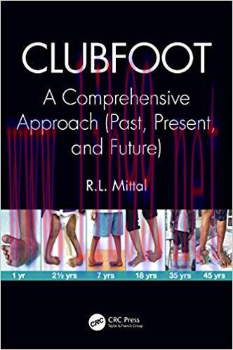[PDF]Clubfoot A Comprehensive Approach